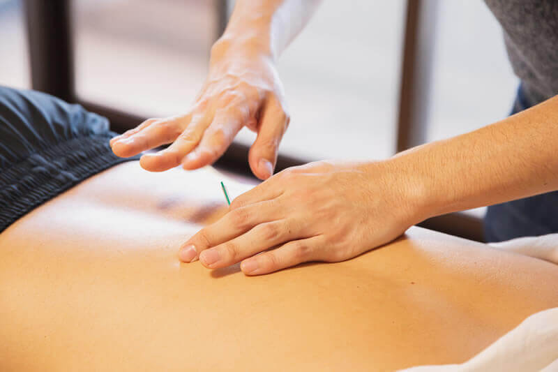 Stockton-Heath-Acupuncture-Therapist